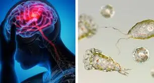 സംസ്ഥാനത്ത് എട്ടു ദിവസത്തിനിടെ 10 പേർക്ക് അമീബിക് മസ്തിഷ്‌ക ജ്വരം; ആർസിസിയിൽ ചികിത്സയിൽ കഴിയുന്ന കാൻസർ ബാധിതനും രോഗബാധ